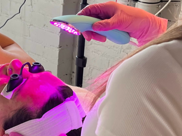 Chemical Peel + LED Therapy